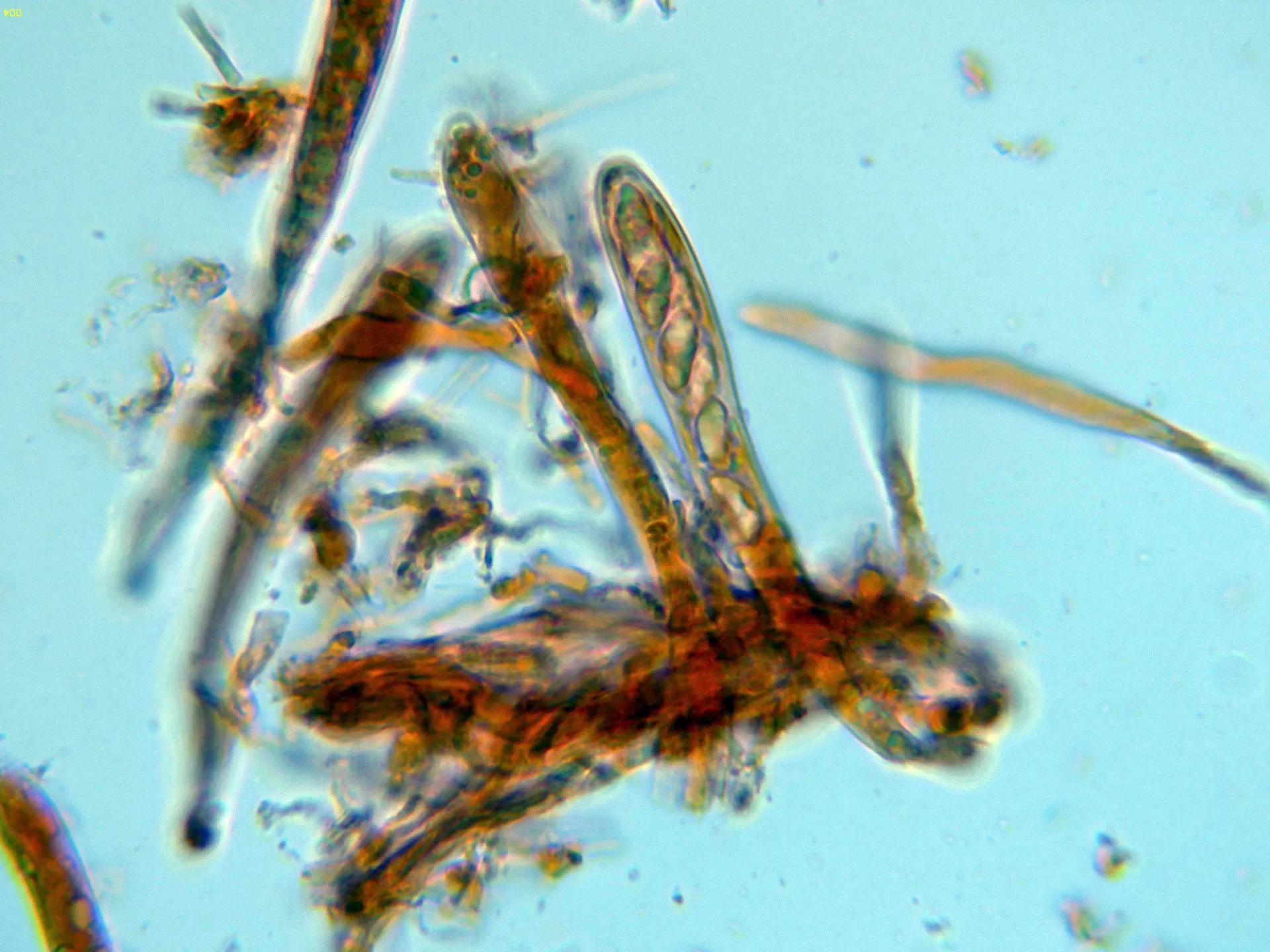Microscopía de Rodwayella sessilis - 11 - Asco-004